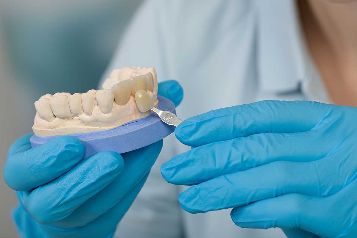 Dental Veneers in Dubai: Understanding Material Choices and Pricing