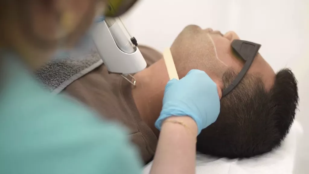 What Pre-Treatment Steps Are Necessary for Laser Hair Removal for Men in Dubai?