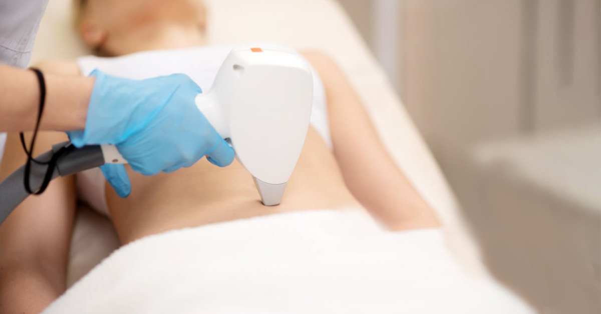 Why Laser Liposuction is a Game-Changer for Fat Reduction in Dubai