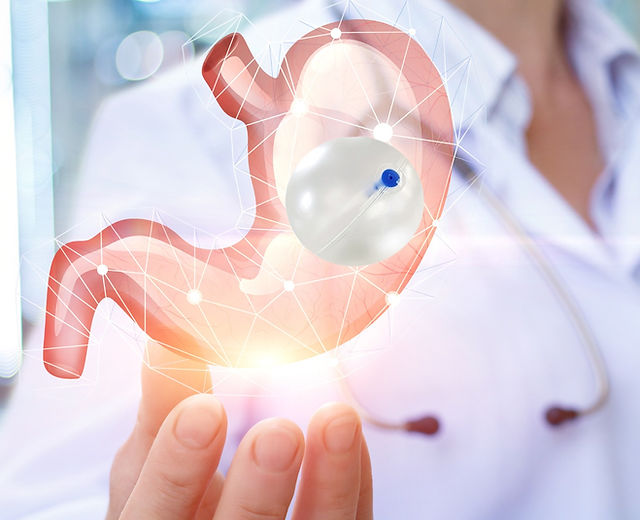 Understanding the Non-Surgical Weight Loss Solution: Gastric Balloons