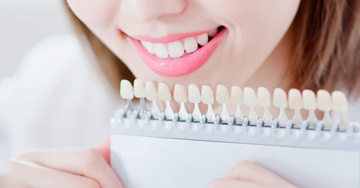 Are Dental Veneers Right for You? Weighing the Choices