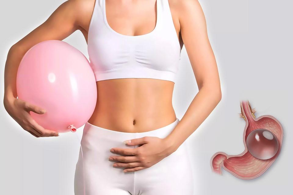 Achieve Sustainable Weight Loss with Gastric Balloon Placement in Dubai