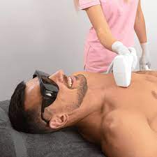 Male Grooming Revolution: The Benefits of Laser Hair Removal for Men