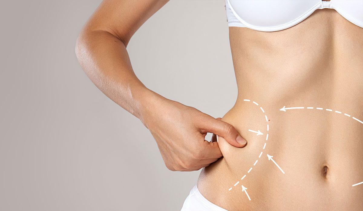 Pre and Post Liposuction Care: A Guide for Dubai Patients