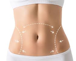 Can Liposuction Help You Lose Weight?