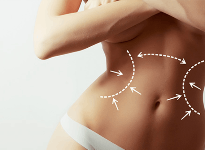 How to Choose the Best Liposuction Technique for Your Body Type in Dubai