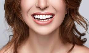 Dental Veneers Aftercare: Tips for Long-Lasting Results