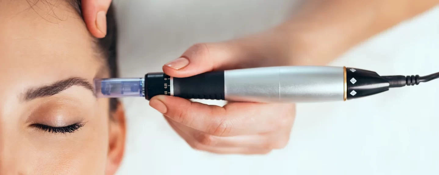 Mesotherapy: A Pathway to Vibrant Skin and Resilient Hair