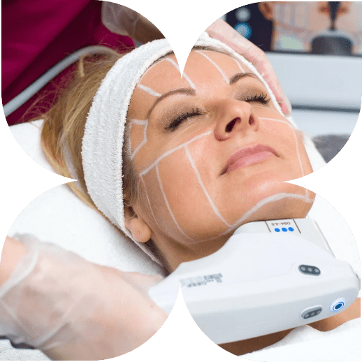 HIFU Treatment: Revolutionizing Non-Surgical Skin Lifting