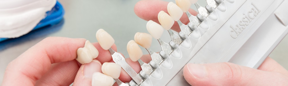 How to Care for Your Dental Veneers & Make Them Last Longer