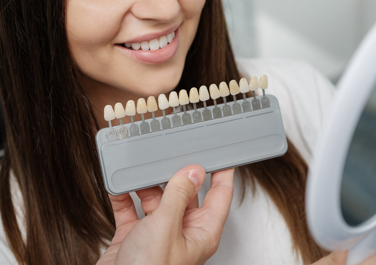 Dental Veneers: An Insight into Their Composition and Choices