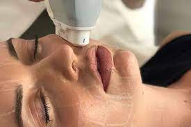 The Efficacy of HIFU in Achieving Tighter, Younger-Looking Skin