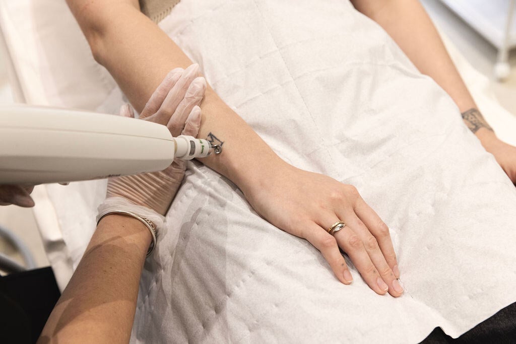 Pico Laser Tattoo Removal: No Scars, No Pain, Just Clear Skin