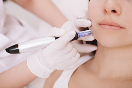 Mesotherapy: A Pathway to Vibrant Skin and Resilient Hair