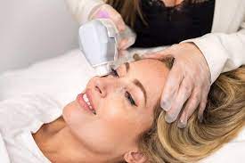 HIFU Treatment: Revolutionizing Non-Surgical Skin Lifting