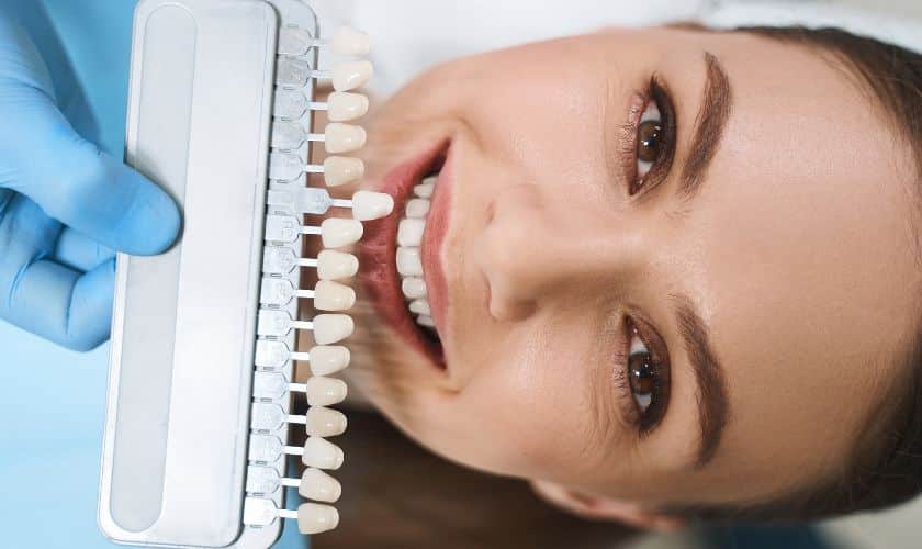 How to Decide If Veneers or Crowns Are Better for You