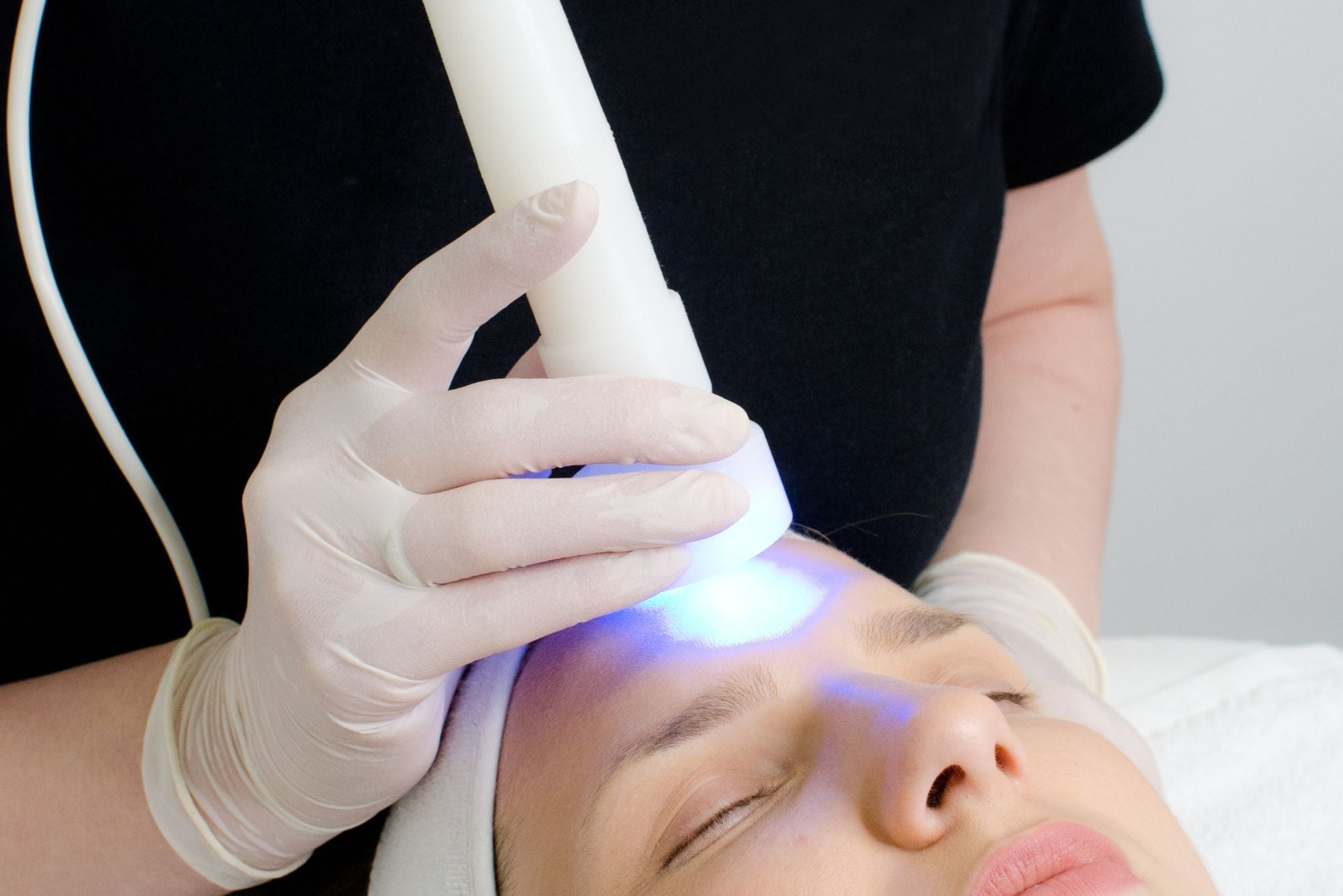 Red and Blue Light Therapy for Acne: How It Works and Its Benefits