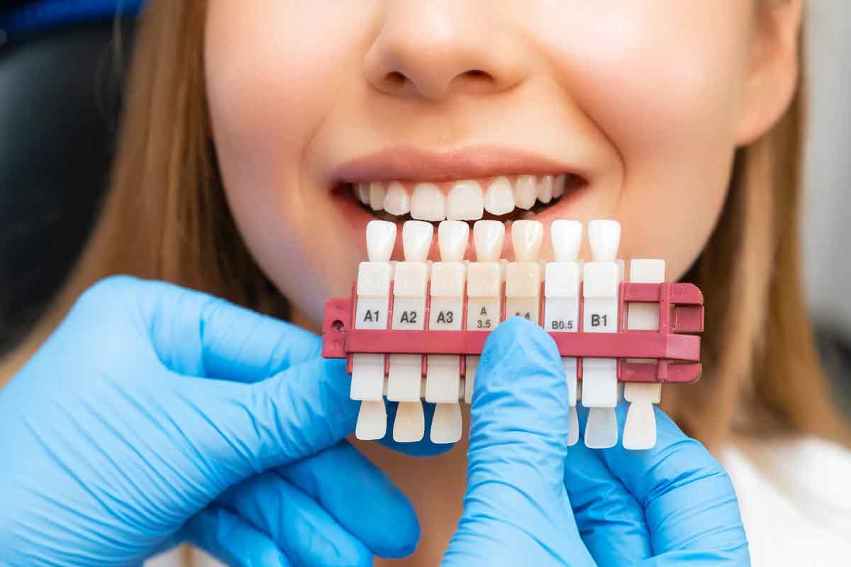 Discovering the Efficiency and Ease of Dental Veneers