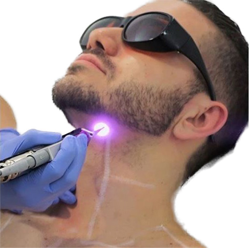 Does Male Laser Hair Removal Really Work for All Skin Types and Hair Colors