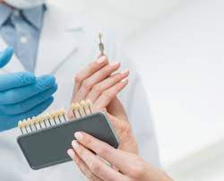 Dental Veneers: A Long-Term Solution for Smile Perfection